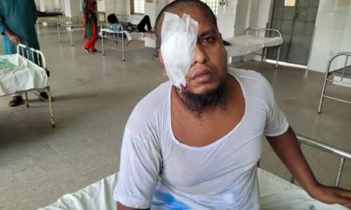 মাওলানা ইউসুফ আলীর চোখের ক্ষতি হয়েছে